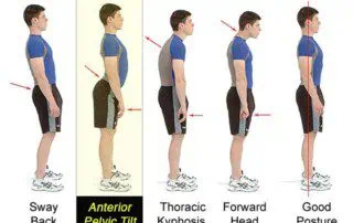 Pelvic Tilt 1
